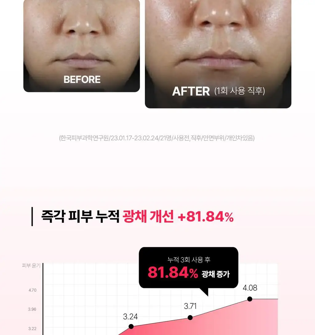 [잡티톤업] 센텔리안24 엑스퍼트 마데카 멜라 캡처 앰플 맥스 15ml 더블기획 (+푸린 수면안대 포켓몬 에디션) 상세페이지 19